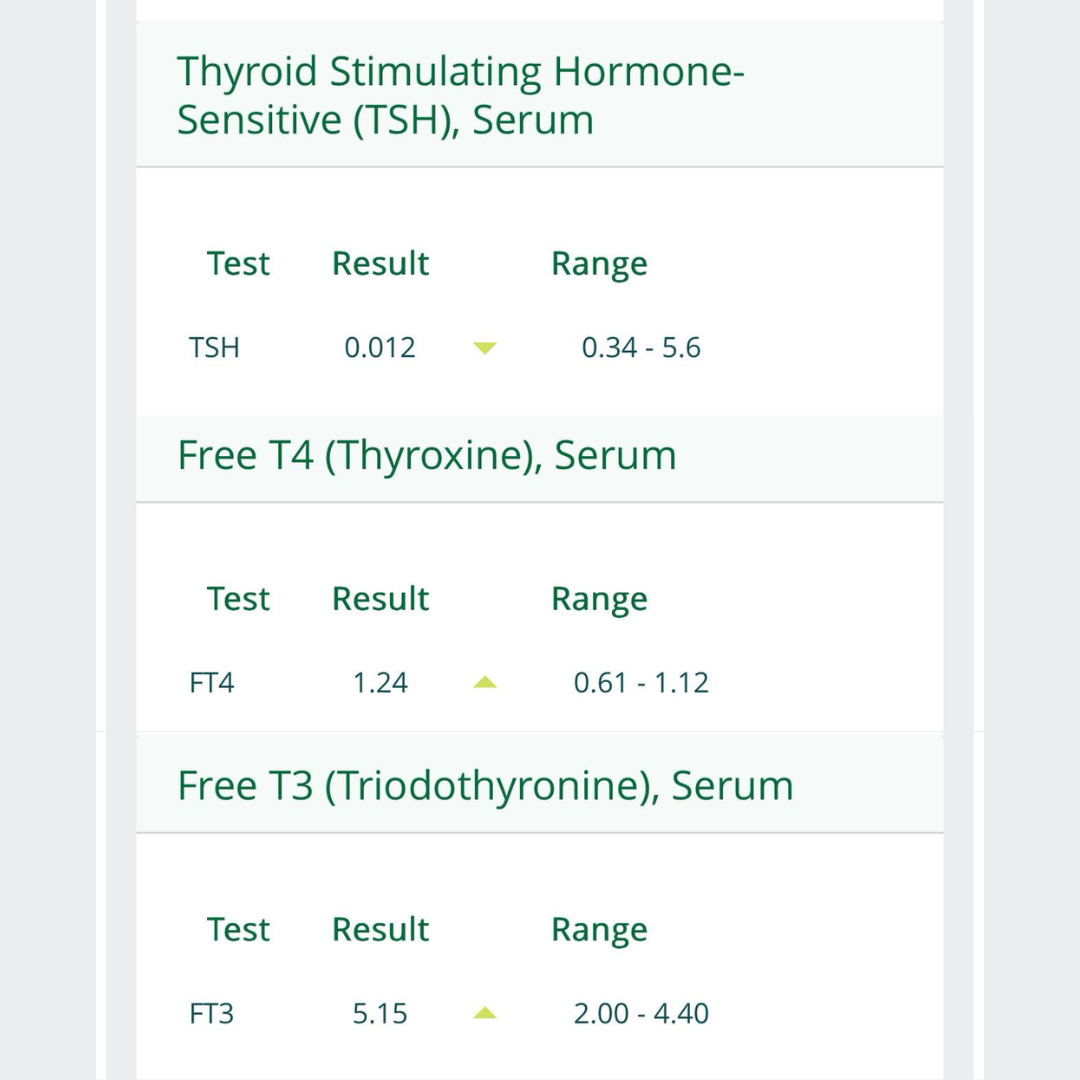 Shahin Bashir's thyroid labs showing TSH FT4 and FT3 all normalised after nutrition program at Nutrition In Sync