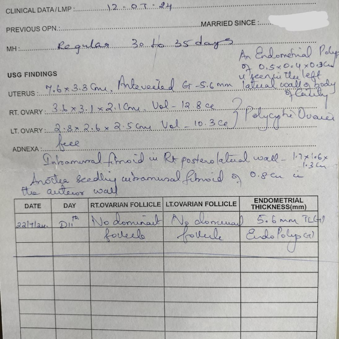pelvic ultrasound report showing fertility-related findings, including a suspected endometrial polyp, polycystic ovaries, small uterine fibroids, no dominant follicle on day 11, and endometrial thickness of 5.6 mm.