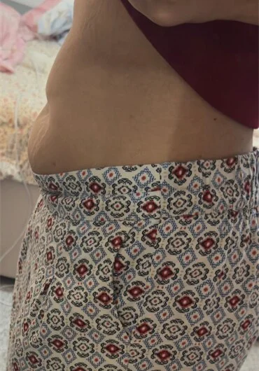 The same client after 15 days on the Community Gut Cleanse, bloating reduced